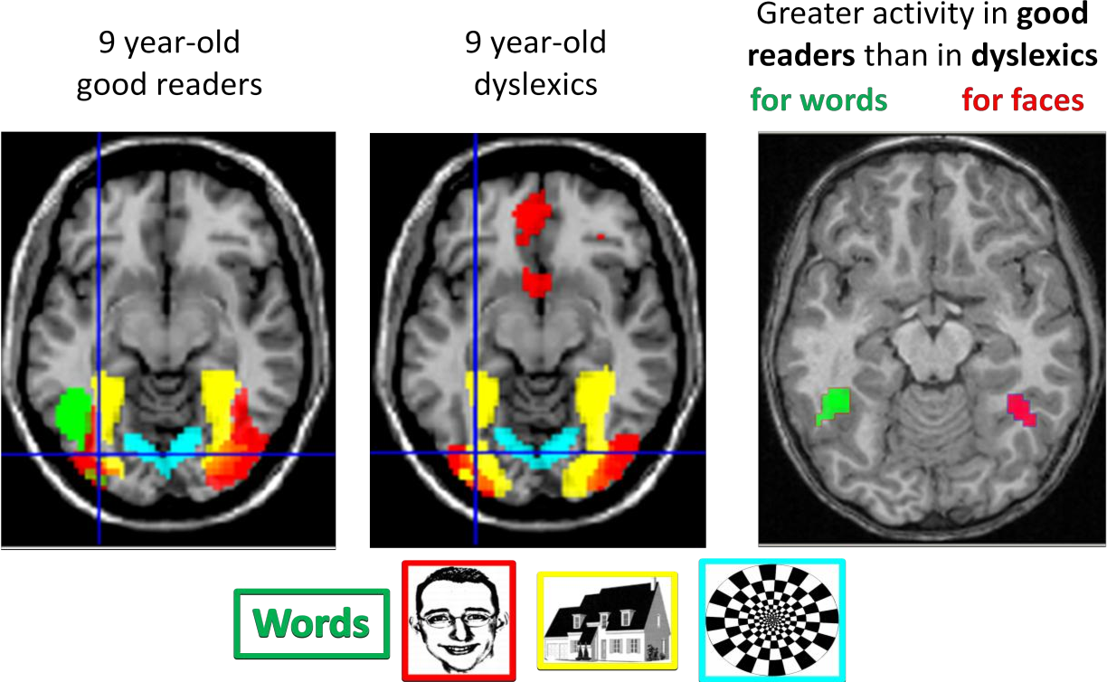 Dehaene S. Inside the letterbox: how literacy transforms the human brain. Cerebrum. 2013 Jun 3;2013:7. PMID: 23847714; PMCID: PMC3704307.